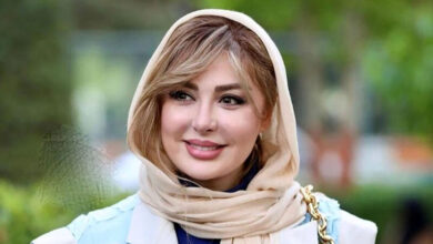 عکس قدیمی چهره متفاوت نیوشا ضیغمی قبل از عمل جراحی
